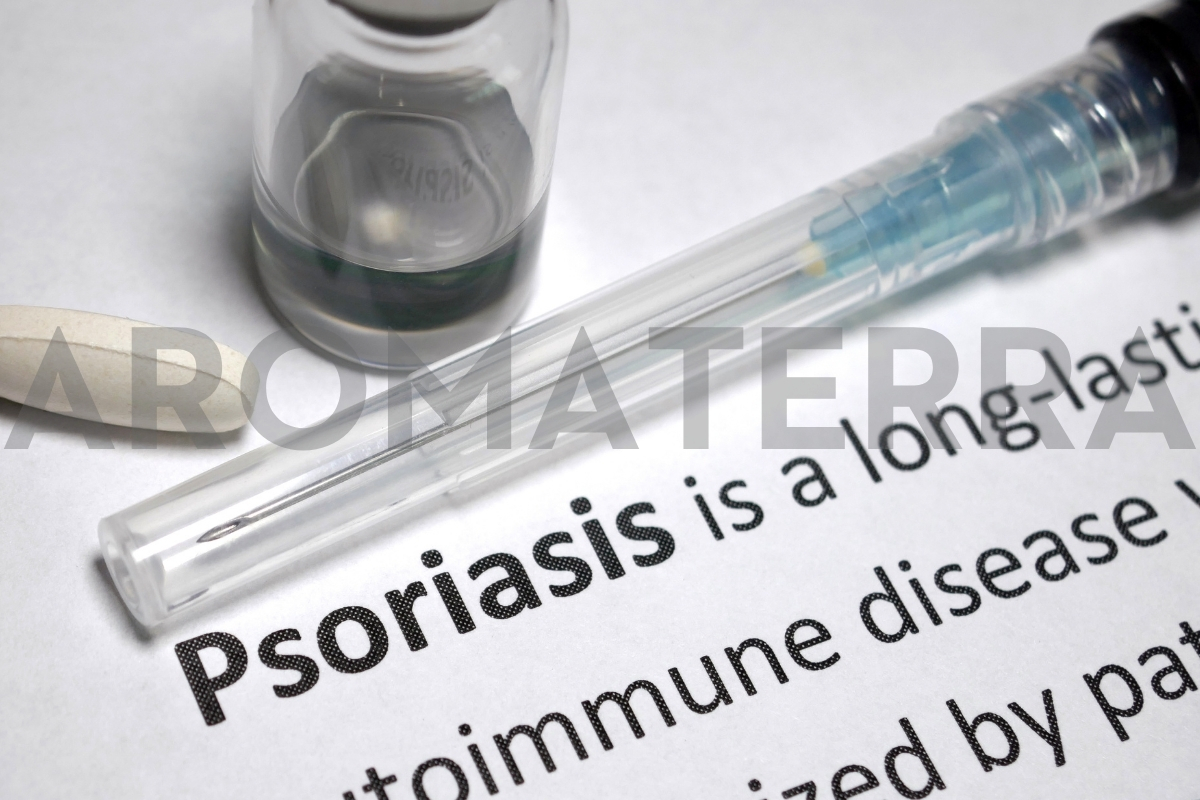psorijaza prirodni lijekovi iz prirode